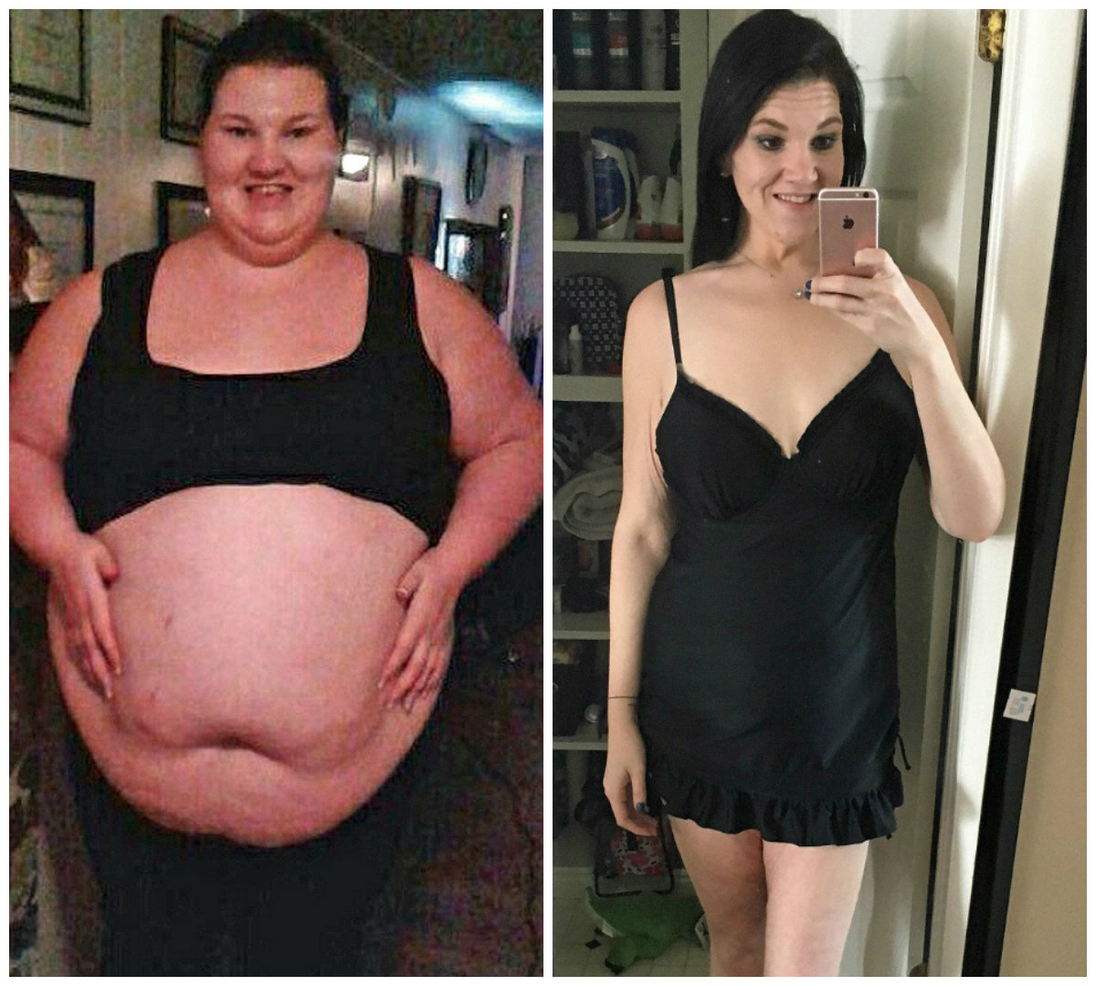 Сильное похудение до и после