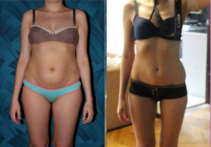 голые похудевшие девушки до и после фото