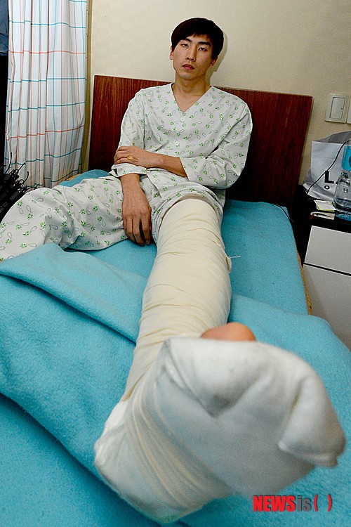 Сломанная нога в гипсе фото мужская