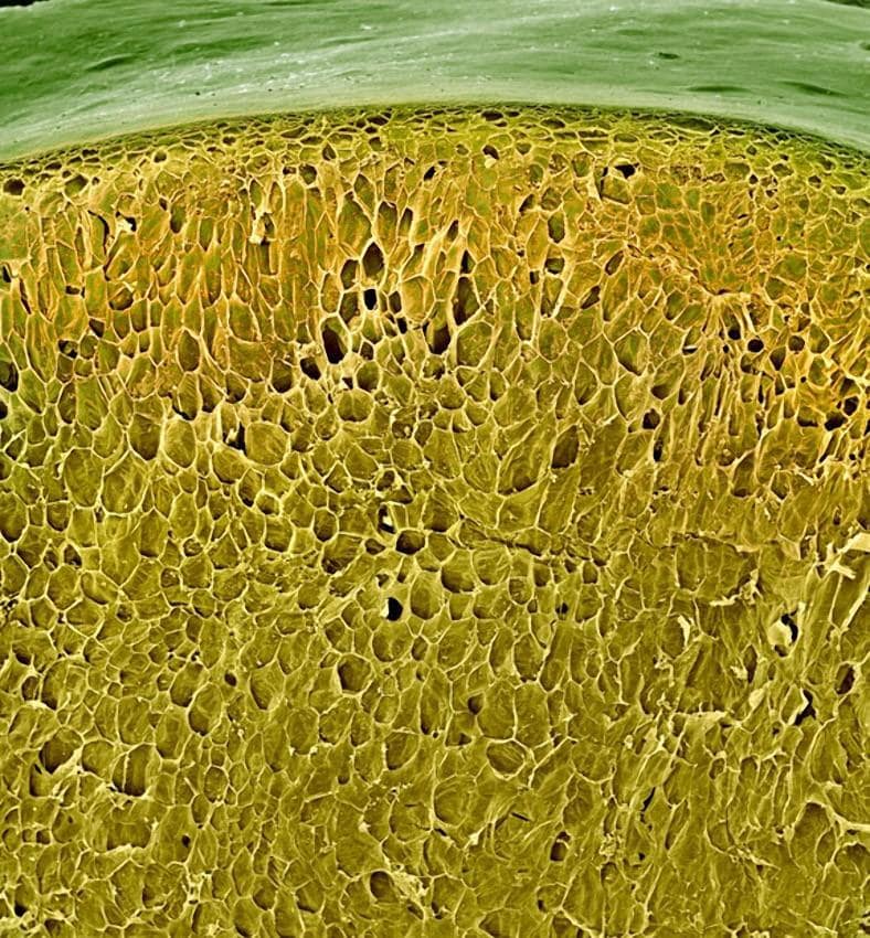 Пыльца одуванчика фото под микроскопом