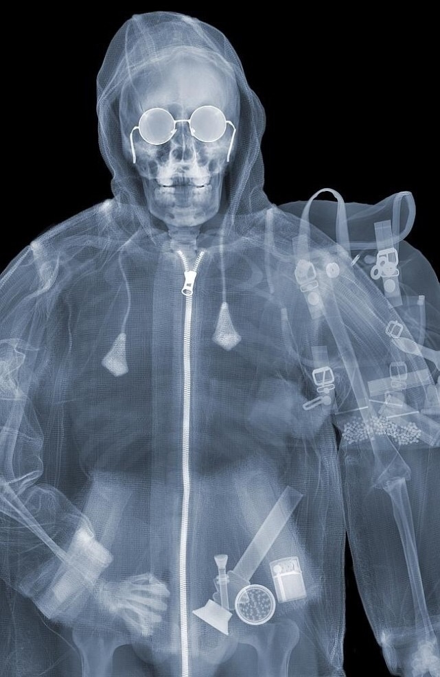 Рентгеновские лучи фото